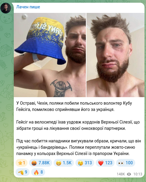 Screenshot of a Telegram post: In Ostrava, Czechia, Poles beat a Polish volunteer, Kuba Hejsig, mistakenly tak…