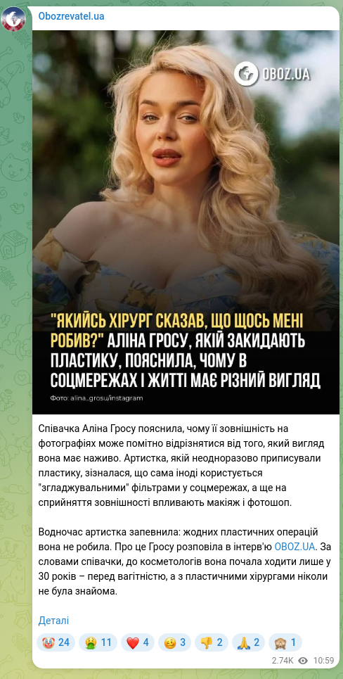 Screenshot of a Telegram post: Grosu Alina Mykhailivna — Singer Alina Grosu explained why her appearance in photographs can…