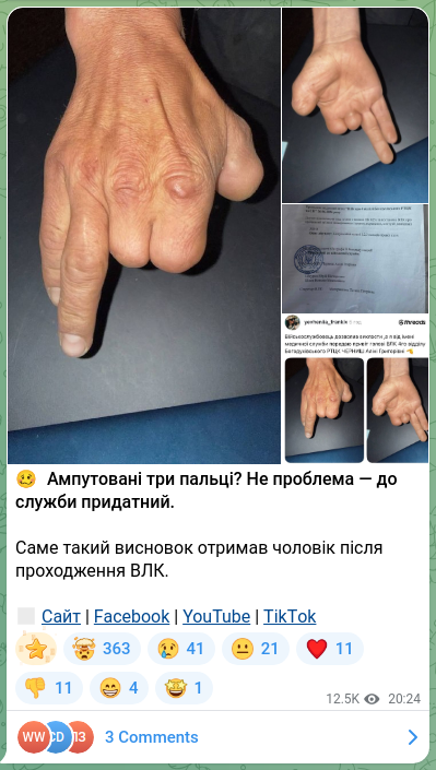 Скріншот Telegram-публікації: 🥴 Ампутовані три пальці? Не проблема — до служби придатний. Саме такий висново…